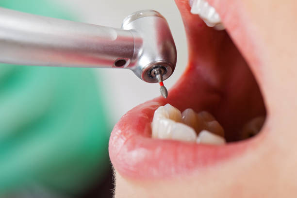 Best Tooth Infection Emergency Dentist  in Beech Mountain Lakes, PA
